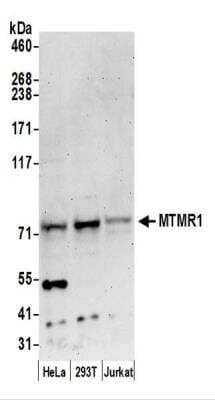 <b>Independent Antibodies Validation and Biological Strategies Validation.</b>Western Blot: MTMR1 Antibody [NBP2-44289] - Samples: Whole cell lysate (50 ug) from HeLa, 293T, and Jurkat cells prepared using NETN lysis buffer.