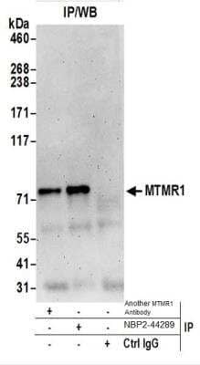 Western Blot: MTMR1 Antibody [NBP2-44289] - Western Blot of Immunoprecipitates. Samples: Whole cell lysate (0.5 or 1.0 mg per IP reaction; 20% of IP loaded) from HeLa cells prepared using NETN lysis buffer. NBP2-44289 was used for IP at 6 ug per reaction. MTMR1 was also immunoprecipitated by another rabbit anti-MTMR1 antibody.