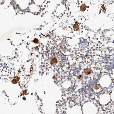 Immunohistochemistry-Paraffin: MTMR11 Antibody [NBP1-90620] - Staining of human bone marrow shows strong cytoplasmic positivity in megakaryocytes.