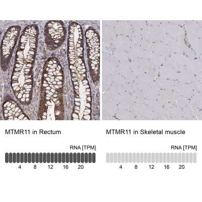 Immunohistochemistry-Paraffin MTMR11 Antibody - BSA Free