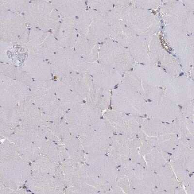 Immunohistochemistry-Paraffin MTMR11 Antibody - BSA Free