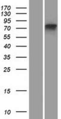 Western Blot MTMR11 Overexpression Lysate