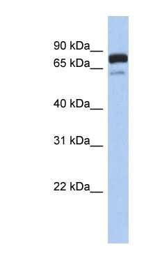 Western Blot: MTMR12 Antibody [NBP1-54988] - Human Brain lysate, concentration 0.2-1 ug/ml.