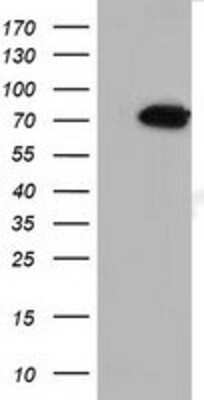 Western Blot: MTMR14 Antibody (6B6) [NBP2-03077] - HEK293T cells were transfected with the pCMV6-ENTRY control (Left lane) or pCMV6-ENTRY MTMR14 (Right lane) cDNA for 48 hrs and lysed. Equivalent amounts of cell lysates (5 ug per lane) were separated by SDS-PAGE and immunoblotted with anti-MTMR14.