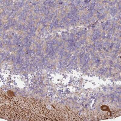Immunohistochemistry-Paraffin: MTMR14 Antibody [NBP2-33703] - Staining of human cerebellum shows strong cytoplasmic positivity in Purkinje cells.