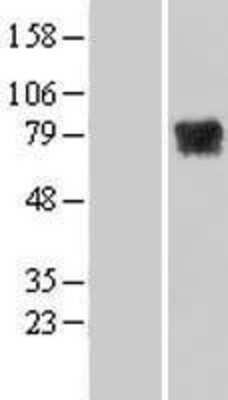 Western Blot: MTMR14 Overexpression Lysate (Adult Normal) [NBL1-13371] Left-Empty vector transfected control cell lysate (HEK293 cell lysate); Right -Over-expression Lysate for MTMR14.