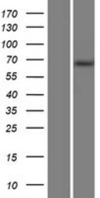 Western Blot: MTMR14 Overexpression Lysate (Adult Normal) [NBP2-08461] Left-Empty vector transfected control cell lysate (HEK293 cell lysate); Right -Over-expression Lysate for MTMR14.