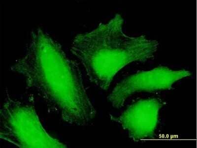 Immunocytochemistry/ Immunofluorescence MTMR15 Antibody - Azide and BSA Free