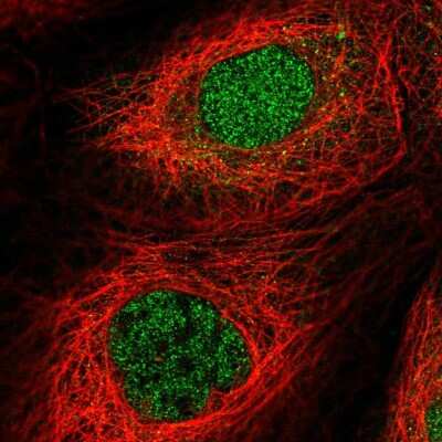 Immunocytochemistry/ Immunofluorescence MTMR15 Antibody - BSA Free