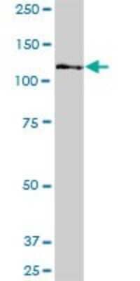 Western Blot MTMR15 Antibody - Azide and BSA Free