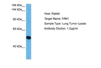 Western Blot: MTMR15 Antibody [NBP2-87856] - Host: Rabbit. Target Name: FAN1. Sample Tissue: Human Lung Tumor lysates. Antibody Dilution: 1ug/ml