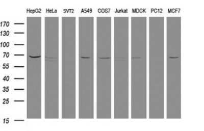 Western Blot: MTMR2 Antibody (OTI1F10) - Azide and BSA Free [NBP2-72810] - Analysis of extracts (35ug) from 9 different cell lines (HepG2: human; HeLa: human; SVT2: mouse; A549: human; COS7: monkey; Jurkat: human; MDCK: canine; PC12: rat; MCF7: human)