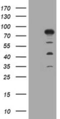 Western Blot: MTMR2 Antibody (OTI1F10) - Azide and BSA Free [NBP2-72810] - Analysis of HEK293T cells were transfected with the pCMV6-ENTRY control (Left lane) or pCMV6-ENTRY MTMR2.