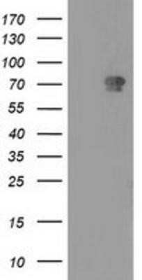 Western Blot: MTMR2 Antibody (OTI2D2) - Azide and BSA Free [NBP2-72809] - HEK293T cells were transfected with the pCMV6-ENTRY control (Left lane) or pCMV6-ENTRY MTMR2 (Right lane) cDNA for 48 hrs and lysed. Equivalent amounts of cell lysates (5 ug per lane) were separated by SDS-PAGE and immunoblotted with anti-MTMR2.