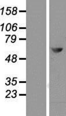 Western Blot: MTMR2 Overexpression Lysate (Adult Normal) [NBP2-04607] Left-Empty vector transfected control cell lysate (HEK293 cell lysate); Right -Over-expression Lysate for MTMR2.