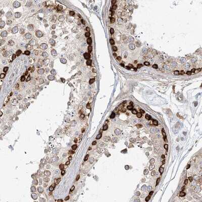 Immunohistochemistry-Paraffin: MTMR3 Antibody [NBP1-81860] - Staining of human testis shows strong cytoplasmic positivity in spermatogonia.