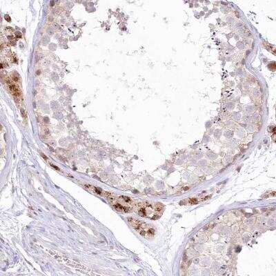 Immunohistochemistry-Paraffin: MTMR3 Antibody [NBP1-81861] - Staining of human testis shows cytoplasmic positivity in Leydig cells.