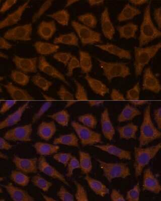 Immunocytochemistry/ Immunofluorescence MTMR4 Antibody - Azide and BSA Free