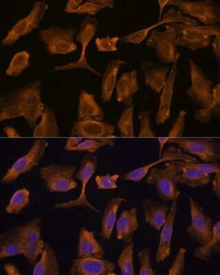 Immunocytochemistry/ Immunofluorescence MTMR4 Antibody - Azide and BSA Free