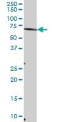 Western Blot: MTMR6 Antibody [H00009107-B01P] - Analysis of MTMR6 expression in human kidney.