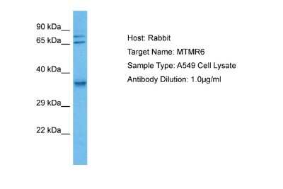 Western Blot: MTMR6 Antibody [NBP2-86717] - Host: Rabbit. Target Name: MTMR6. Sample Tissue: Human A549 Whole Cell lysates. Antibody Dilution: 1ug/ml