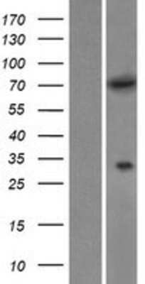 Western Blot: MTMR6 Overexpression Lysate (Adult Normal) [NBP2-07840] Left-Empty vector transfected control cell lysate (HEK293 cell lysate); Right -Over-expression Lysate for MTMR6.