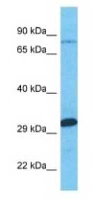 Western Blot: MTMR7 Antibody [NBP3-09576] - Western blot analysis of MTMR7 in Jurkat Whole Cell lysates. Antibody dilution at 1.0ug/ml