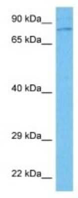 Western Blot: MTMR7 Antibody [NBP3-10053] - Western blot analysis of MTMR7 in Human Du145 Whole Cell lysates. Antibody dilution at 1ug/ml