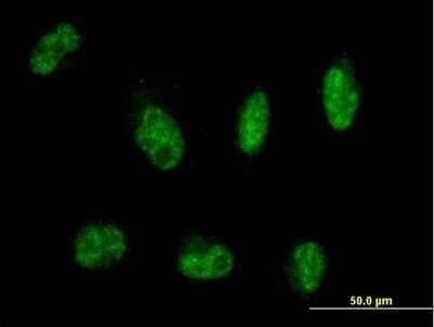 Immunocytochemistry/Immunofluorescence: MTMR8 Antibody [H00055613-B01P] - Analysis of purified antibody to MTMR8 on HepG2 cell. (antibody concentration 10 ug/ml)