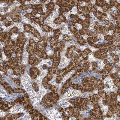 Immunohistochemistry: ASB12 Antibody [NBP2-46775] - Staining of human liver tissue shows strong cytoplasmic positivity in hepatocytes.