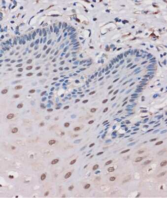 Immunohistochemistry-Paraffin: MTMR8 Antibody [NBP2-94380] - Immunohistochemistry of paraffin-embedded Human esophageal using MTMR8 Rabbit pAb (NBP2-94380) at dilution of 1:100 (40x lens). Perform microwave antigen retrieval with 10 mM PBS buffer pH 7.2 before commencing with IHC staining protocol.