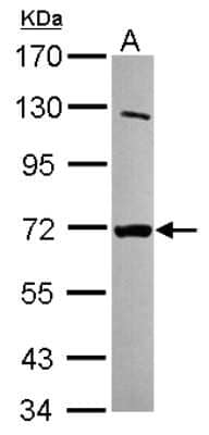 Western Blot MTMR8 Antibody