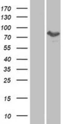 Western Blot MTMR8 Overexpression Lysate