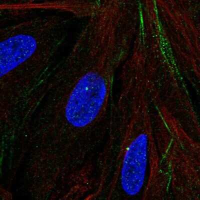 Immunocytochemistry/Immunofluorescence: MTMR9 Antibody [NBP2-57980] - Staining of human cell line BJ shows localization to centrosome & actin filaments.