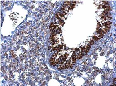 Immunohistochemistry-Paraffin: MTMR9 Antibody [NBP1-31078] -  Paraffin-embedded mouse lung.  MTMR9 antibody [C3], C-term diluted at 1:500.