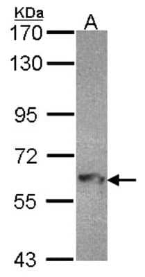 Western Blot: MTMR9 Antibody [NBP1-31078] - Sample (30 ug of whole cell lysate) A: Hep G2 7. 5% SDS PAGE MTMR9 antibody, antibody diluted at 1:1000.