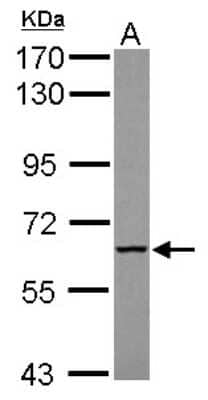 Western Blot: MTMR9 Antibody [NBP2-19435] - Sample (30 ug of whole cell lysate) A: HeLa 7. 5% SDS PAGE gel, diluted at 1:1000.