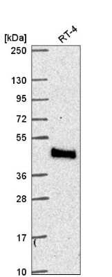 Western Blot: MTMR9 Antibody [NBP2-57980] - Western blot analysis in human cell line RT-4.