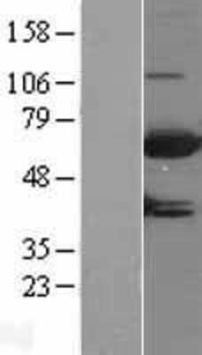 Western Blot: MTMR9 Overexpression Lysate (Adult Normal) [NBL1-13377] Left-Empty vector transfected control cell lysate (HEK293 cell lysate); Right -Over-expression Lysate for MTMR9.