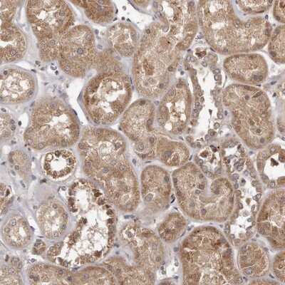 Immunohistochemistry-Paraffin MTO1 Antibody - BSA Free