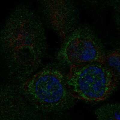 Immunocytochemistry/Immunofluorescence: MTP18 Antibody [NBP2-57803] - Staining of human cell line A-431 shows localization to mitochondria.