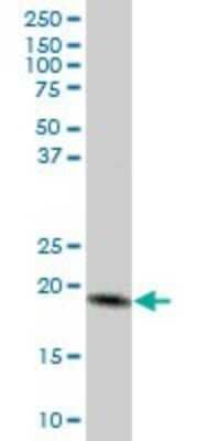 Western Blot: MTP18 Antibody [H00051537-B01P] - Analysis of MTP18 expression in human liver.