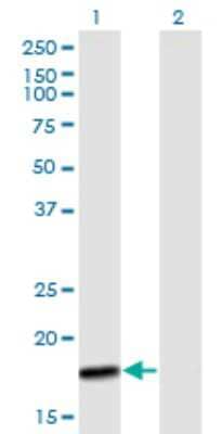 Western Blot: MTP18 Antibody [H00051537-B01P] - Analysis of MTP18 expression in transfected 293T cell line by MTP18 polyclonal antibody.  Lane 1: MTP18 transfected lysate(18.26 KDa). Lane 2: Non-transfected lysate.