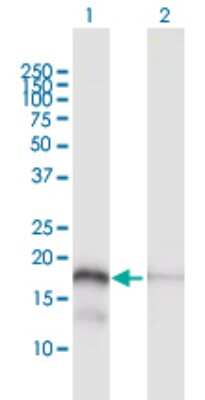 Western Blot: MTP18 Antibody [H00051537-D01P] - Analysis of MTP18 expression in transfected 293T cell line by MTP18 polyclonal antibody.Lane 1: MTP18 transfected lysate(18.00 KDa).Lane 2: Non-transfected lysate.