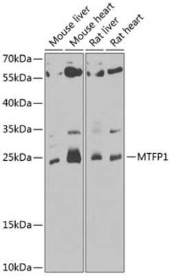 Western Blot: MTP18 Antibody [NBP2-93000] - Analysis of extracts of various cell lines, using MTP18 .Exposure time: 30s.