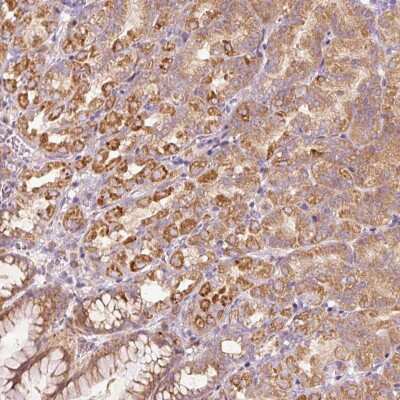 Immunohistochemistry: MTR120 Antibody [NBP2-30819] - Staining of human stomach, upper shows strong cytoplasmic positivity in glandular cells.