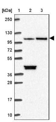 Western Blot: MTR120 Antibody [NBP2-30819] - Lane 1: Marker  [kDa] 250, 130, 95, 72, 55, 36, 28, 17, 10.  Lane 2: Human cell line RT-4.  Lane 3: Human cell line U-251MG sp