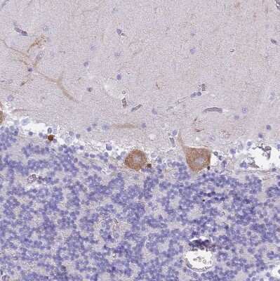 Immunohistochemistry-Paraffin: MTSS1L Antibody [NBP2-14642] - Staining of human cerebellum shows weak to moderate cytoplasmic positivity in Purkinje cells.