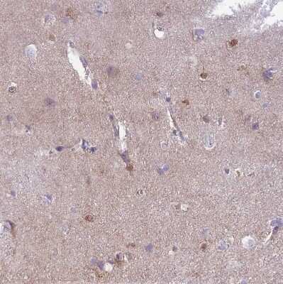 Immunohistochemistry-Paraffin: MTSS1L Antibody [NBP2-14642] - Staining of human cerebral cortex shows weak cytoplasmic positivity in glial cells.