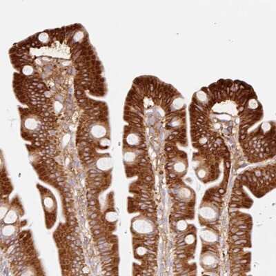 Immunohistochemistry: MTTP Antibody [NBP2-49154] - Staining of human small intestine shows strong cytoplasmic positivity in glandular cells.
